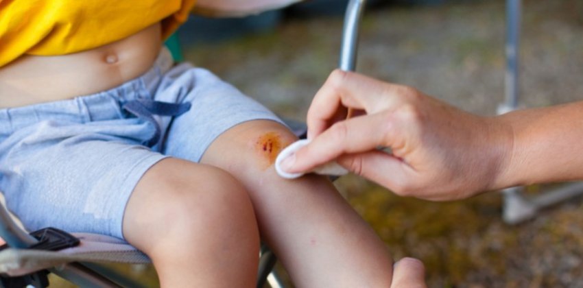 Какие травмы подстерегают детишек летом - «Здоровье»
