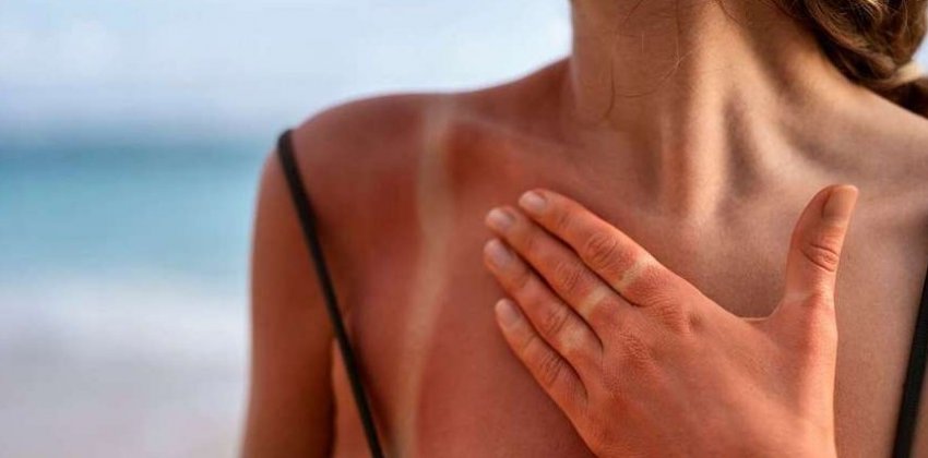 Как позаботиться о коже летом - «Здоровье»